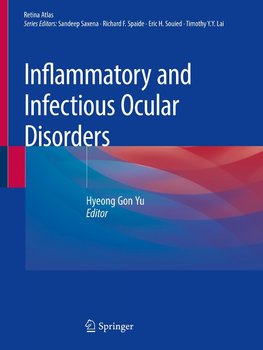 Inflammatory and Infectious Ocular Disorders