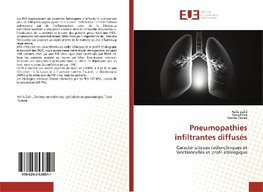 Pneumopathies infiltrantes diffusés