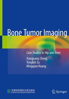 Bone Tumor Imaging