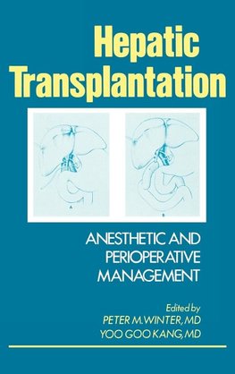 Hepatic Transplantation