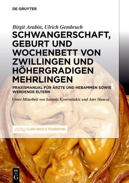 Schwangerschaft, Geburt und Wochenbett von Zwillingen und höhergradigen Mehrlingen