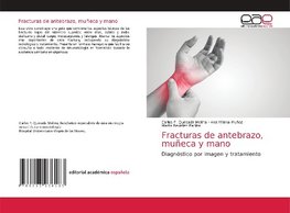 Fracturas de antebrazo, muñeca y mano