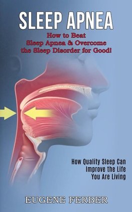 Sleep Apnea