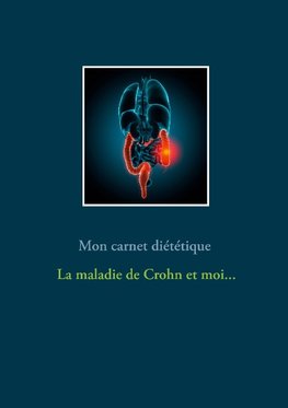 Mon carnet diététique : la maladie de Crohn et moi...