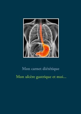 Mon carnet diététique : mon ulcère gastrique et moi...