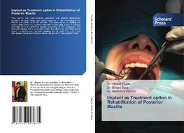 Implant as Treatment option in Rehabilitation of Posterior Maxilla