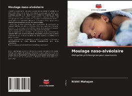 Moulage naso-alvéolaire