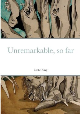 Unremarkable, so far