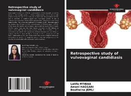 Retrospective study of vulvovaginal candidiasis