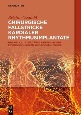 Chirurgische Fallstricke kardialer Rhythmusimplantate