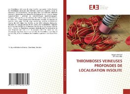 THROMBOSES VEINEUSES PROFONDES DE LOCALISATION INSOLITE