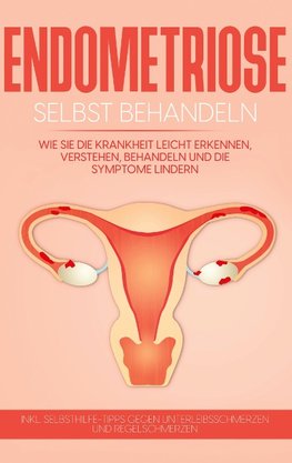 Endometriose selbst behandeln: Wie Sie die Krankheit leicht erkennen, verstehen, behandeln und die Symptome lindern - inkl. Selbsthilfe-Tipps gegen Unterleibsschmerzen und Regelschmerzen