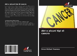 Akt e alcuni tipi di cancro