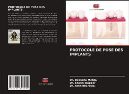 PROTOCOLE DE POSE DES IMPLANTS