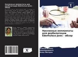 Naklonnye implantaty dlq reabilitacii Edentulous Jaws - obzor