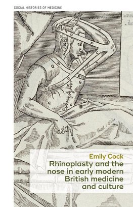 Rhinoplasty and the nose in early modern British medicine and culture