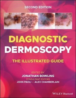 Diagnostic Dermoscopy