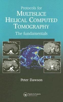 Peter, D: Protocols for Multislice Helical Computed Tomograp