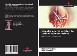 Macular edema related to retinal vein occlusions