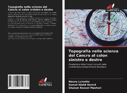 Topografia nella scienza del Cancro al colon sinistro e destro