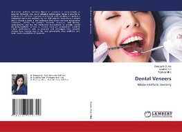 Dental Veneers