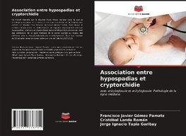 Association entre hypospadias et cryptorchidie