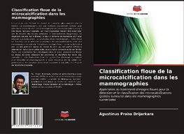 Classification floue de la microcalcification dans les mammographies