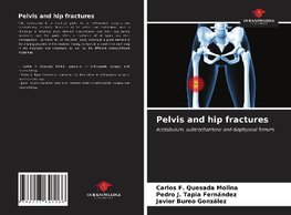 Pelvis and hip fractures