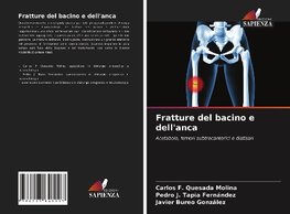 Fratture del bacino e dell'anca