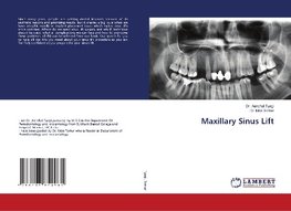 Maxillary Sinus Lift