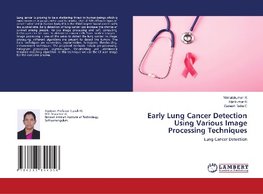 Early Lung Cancer Detection Using Various Image Processing Techniques