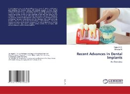 Recent Advances In Dental Implants