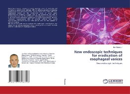 New endoscopic techniques for eradication of esophageal varices