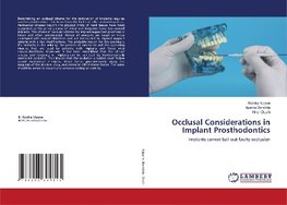 Occlusal Considerations in Implant Prosthodontics