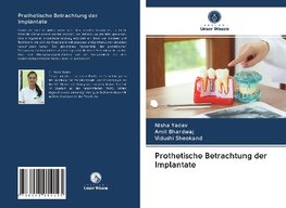 Prothetische Betrachtung der Implantate