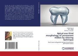 Apical one third morphology of permanent molars by clearing technique