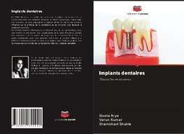 Implants dentaires