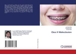 Class II Malocclusion