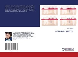 PERI-IMPLANTITIS