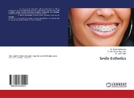 Smile Esthetics