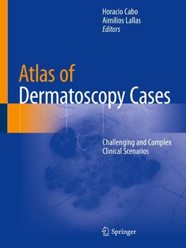 Atlas of Dermatoscopy Cases