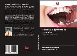 Lésions pigmentées buccales