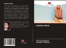 Lamina Dura