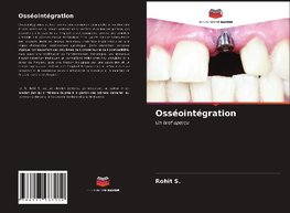 Osséointégration