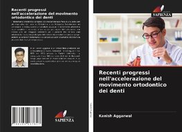 Recenti progressi nell'accelerazione del movimento ortodontico dei denti