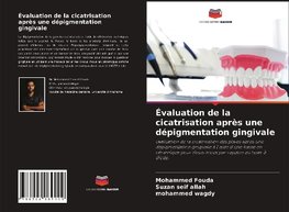 Évaluation de la cicatrisation après une dépigmentation gingivale