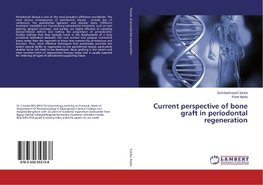 Current perspective of bone graft in periodontal regeneration