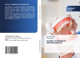 NICKEL TITANIUM IN ORTHODONTICS