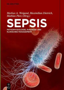 Sepsis