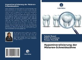 Hypomineralisierung der Molaren-Schneidezähne